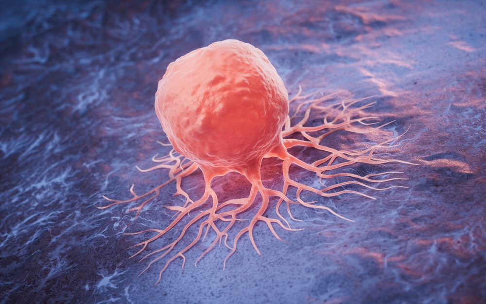 Cancer Specialist in AP